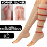 Orthopedische compressiekousen met rits - ComfortZip