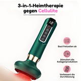 Anti-Cellulite-Cupping-Apparaat – SlimCupp