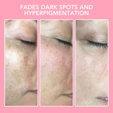 Kurkuma Kojiczuur Reinigingspads - GlowTonic