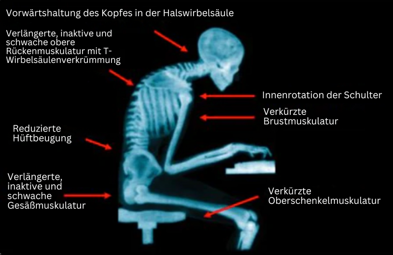 EMS-Houdingsbandage - PosturePro