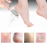 Soft Feet | Nooit meer eelt op je voeten!