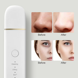 Diepe Reinigings Huid Scrubber