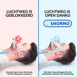 Anti-Snurk Beugel - Premium Comfort Snurkpreventie