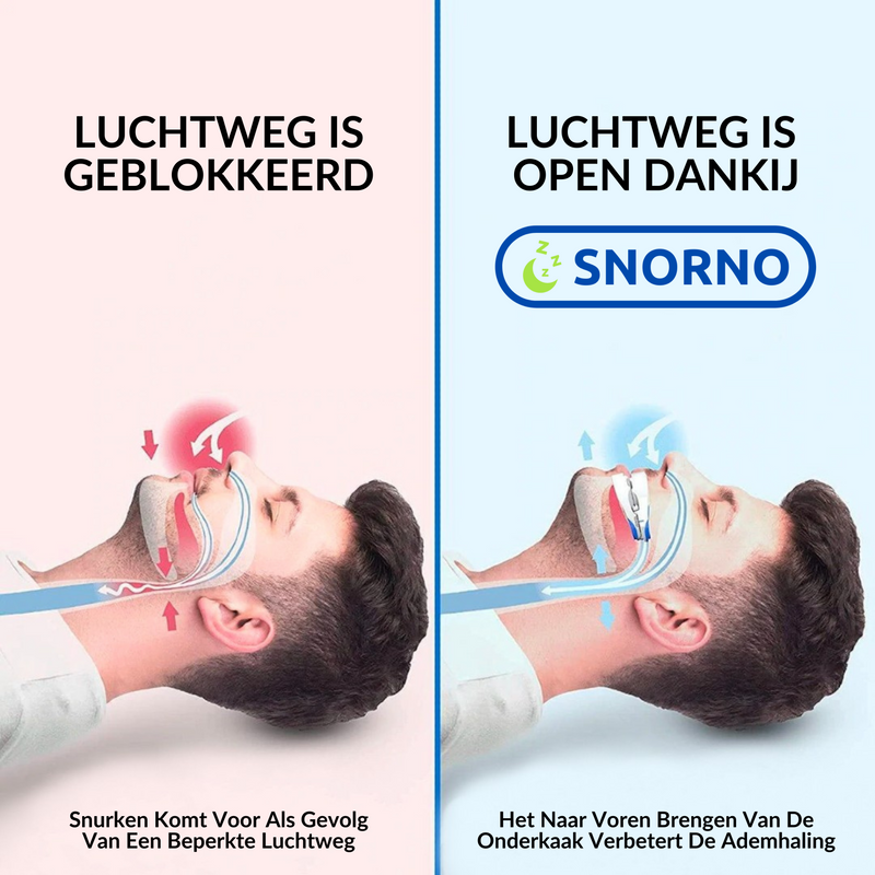 Anti-Snurk Beugel - Premium Comfort Snurkpreventie