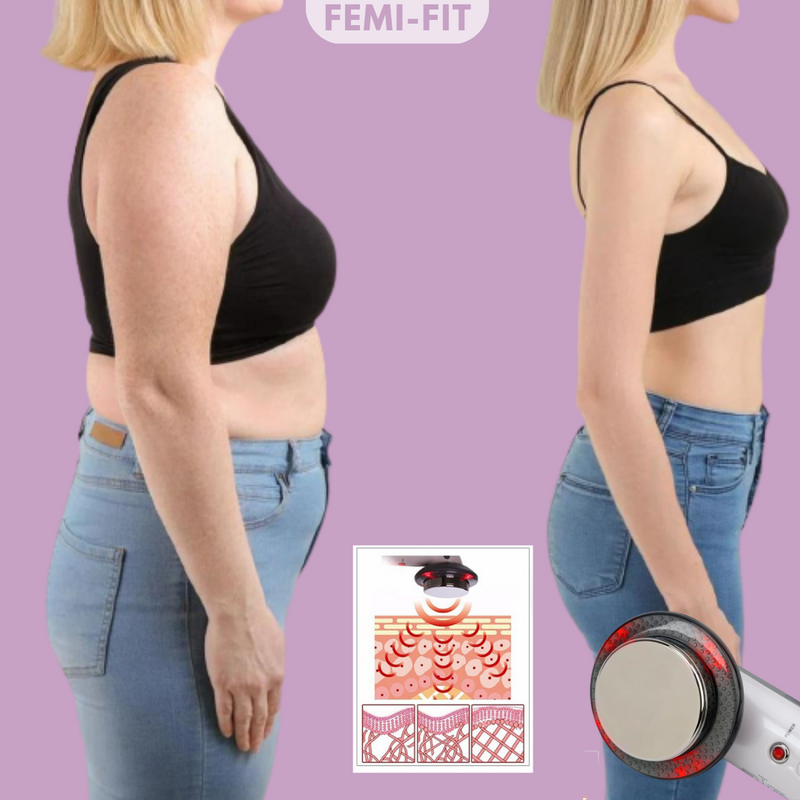 3-in-1 Vet- en Celluliteverwijderaar – SlimShape